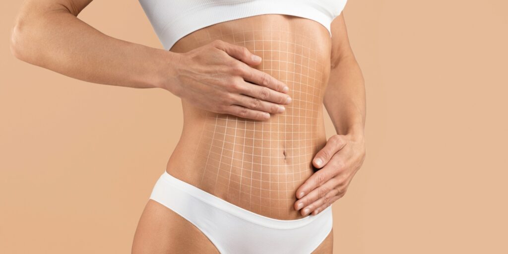 liposuccion con la doctora silvia rojas