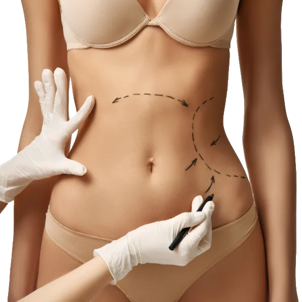 abdominoplastia - cirugía de mama con la doctora silvia rojas